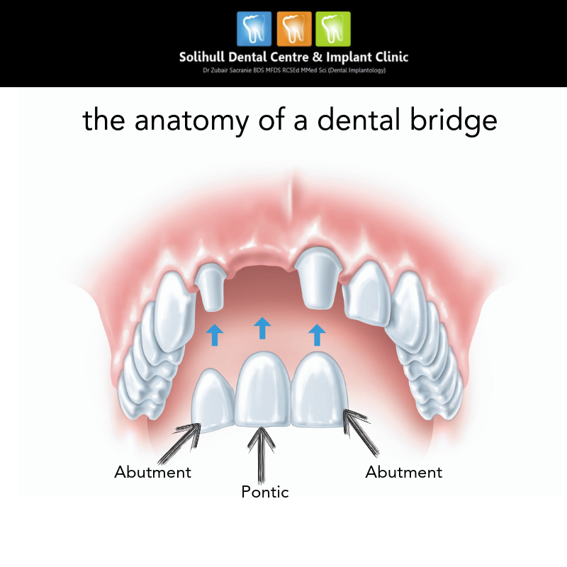 The anatomy of the dental Crown