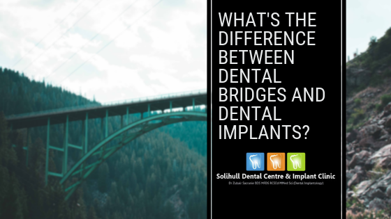 the difference between dental bridges and implants