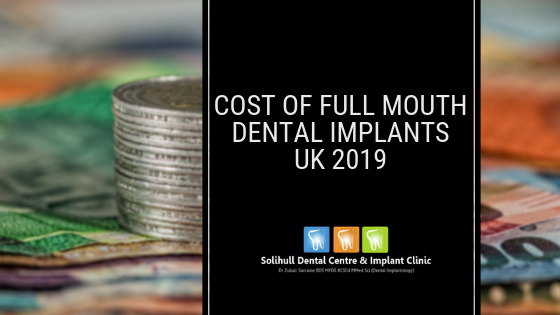 costs of full mouth dental implants