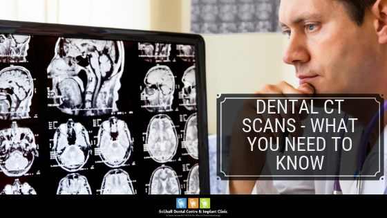 Dental CT Scans what you need to know