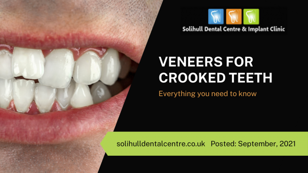 Veneers For Crooked Teeth