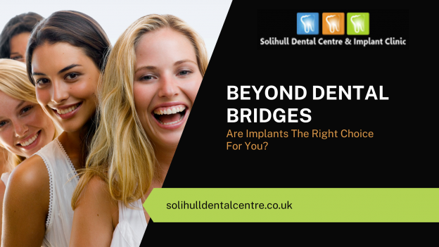 Beyond Dental Bridges - Are Implants The Right Choice For You