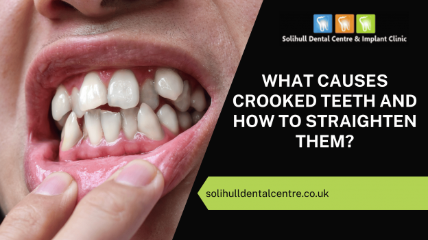 What Causes Crooked Teeth and How to Straighten Them?